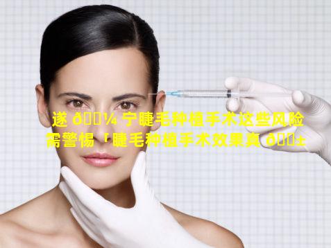 遂 🌼 宁睫毛种植手术这些风险需警惕「睫毛种植手术效果真 🐱 人案例」